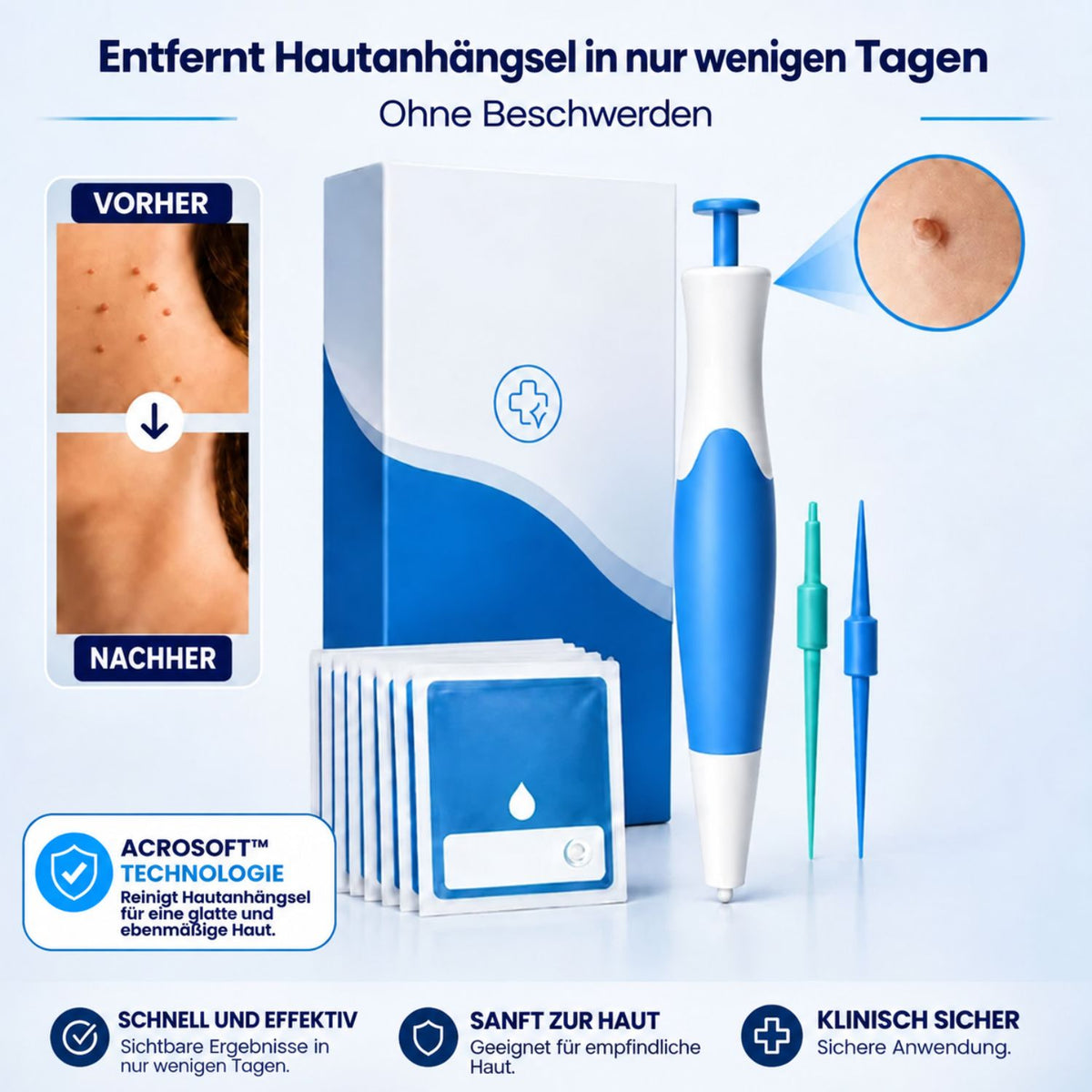 AcroSoft™ | Glatte Haut in nur 4 Tagen