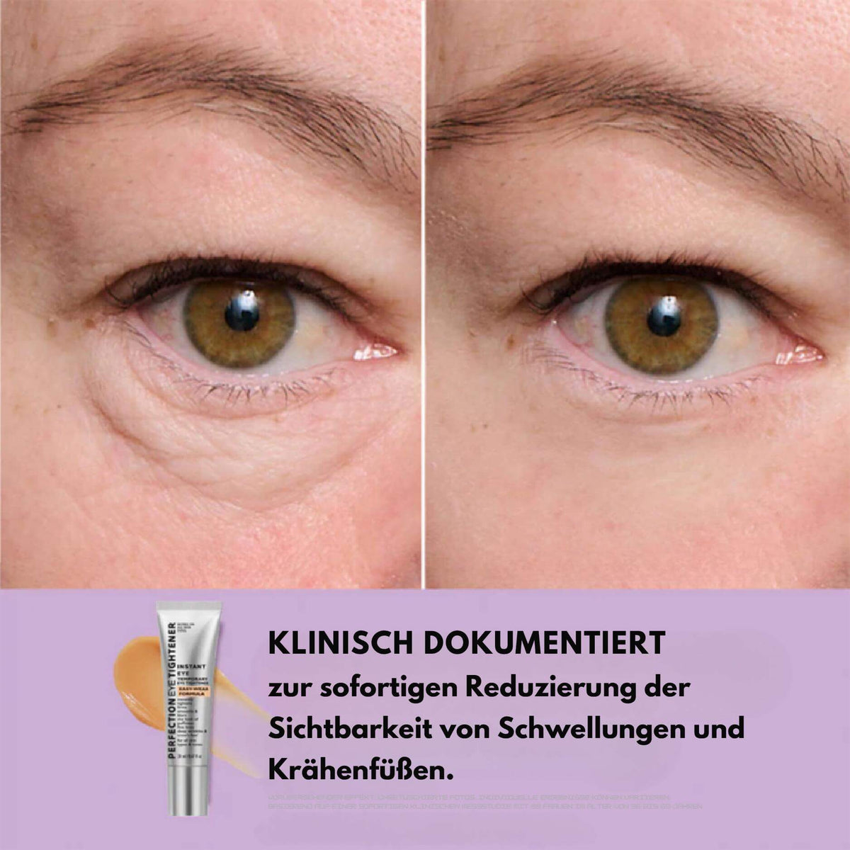 EyeMiracle™ | Augenstraffungs-Creme | Reduziert Tränensäcke, Schwellungen und feine Linien in Sekunden - Science Factory DE