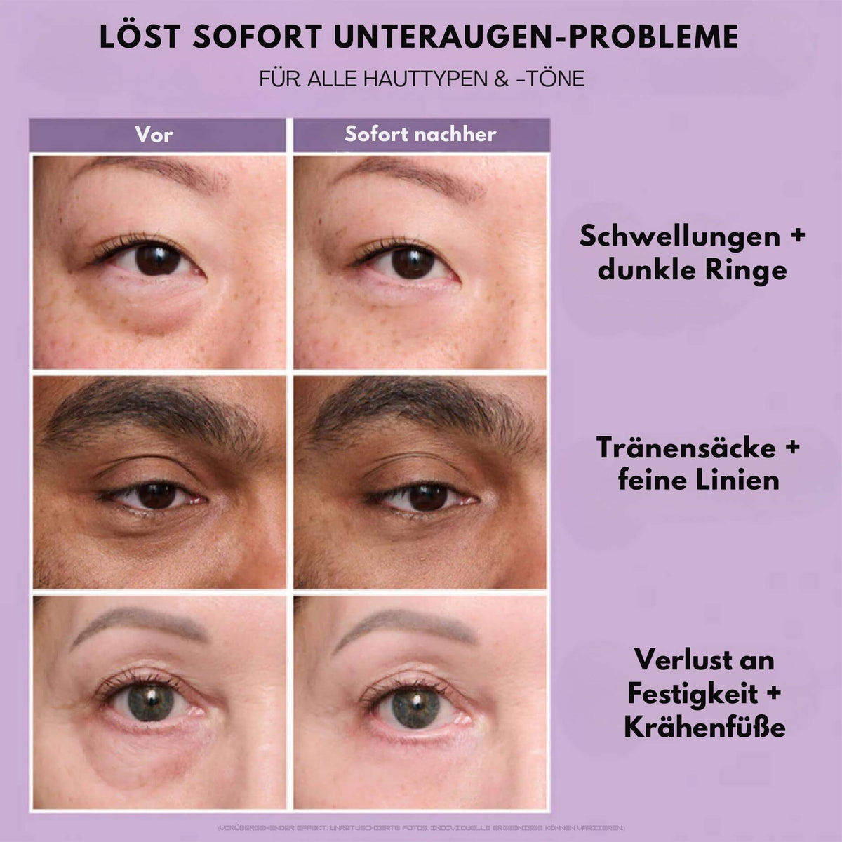 EyeMiracle™ | Augenstraffungs-Creme | Reduziert Tränensäcke, Schwellungen und feine Linien in Sekunden - Science Factory DE