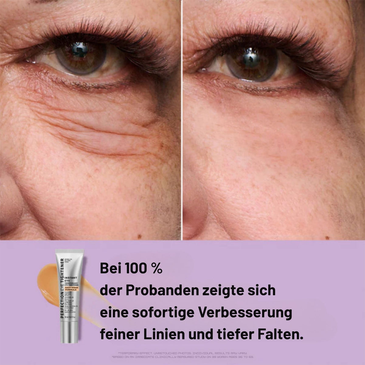 EyeMiracle™ | Augenstraffungs-Creme | Reduziert Tränensäcke, Schwellungen und feine Linien in Sekunden - Science Factory DE