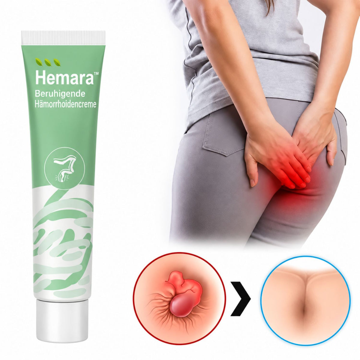 HemoraCare™ | Pflanzliche Hämorrhoidencreme | Lindert 99 % der Hämorrhoiden bereits nach der ersten Anwendung - Science Factory DE